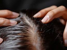 How Do Exosomes Promote Hair Growth?