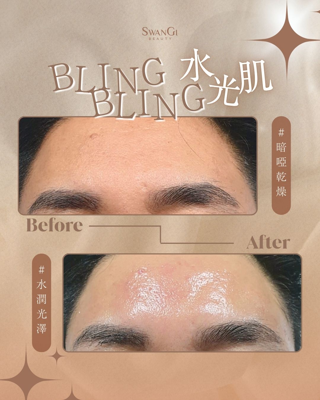 Bling Bling 水光肌