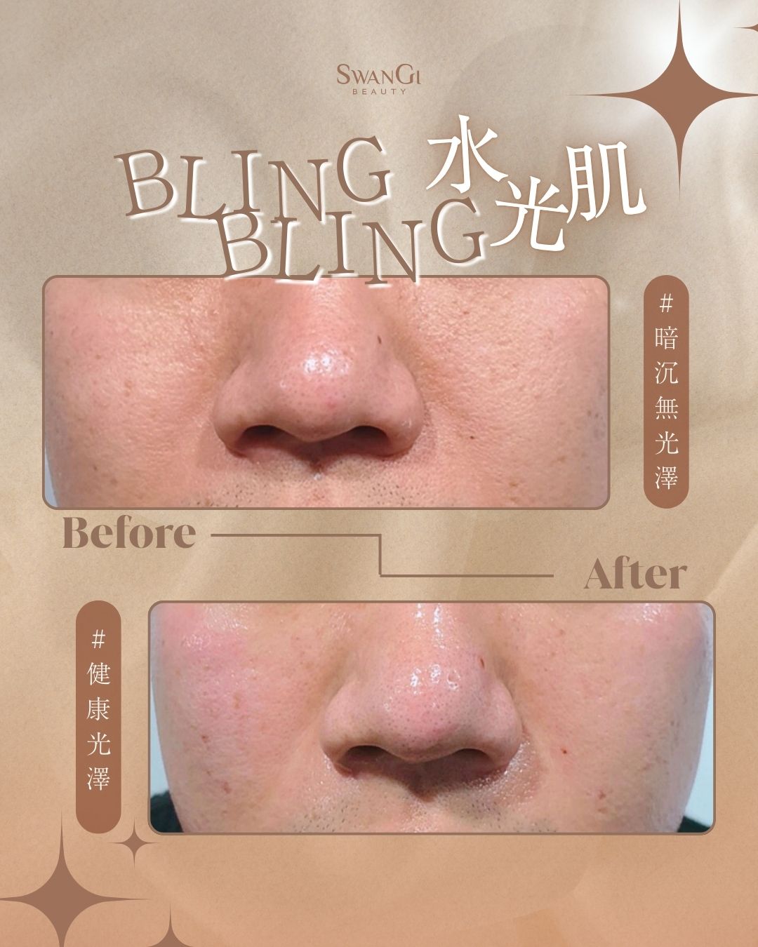 Bling Bling 水光肌